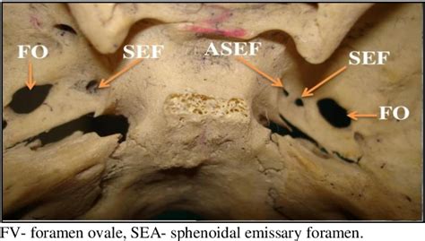 耳珠位置|Visual Anatomy 視覚解剖学